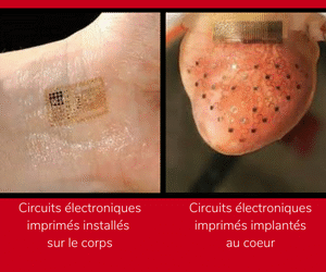 Circuits électroniques imprimés installés sur le corps FR NEW